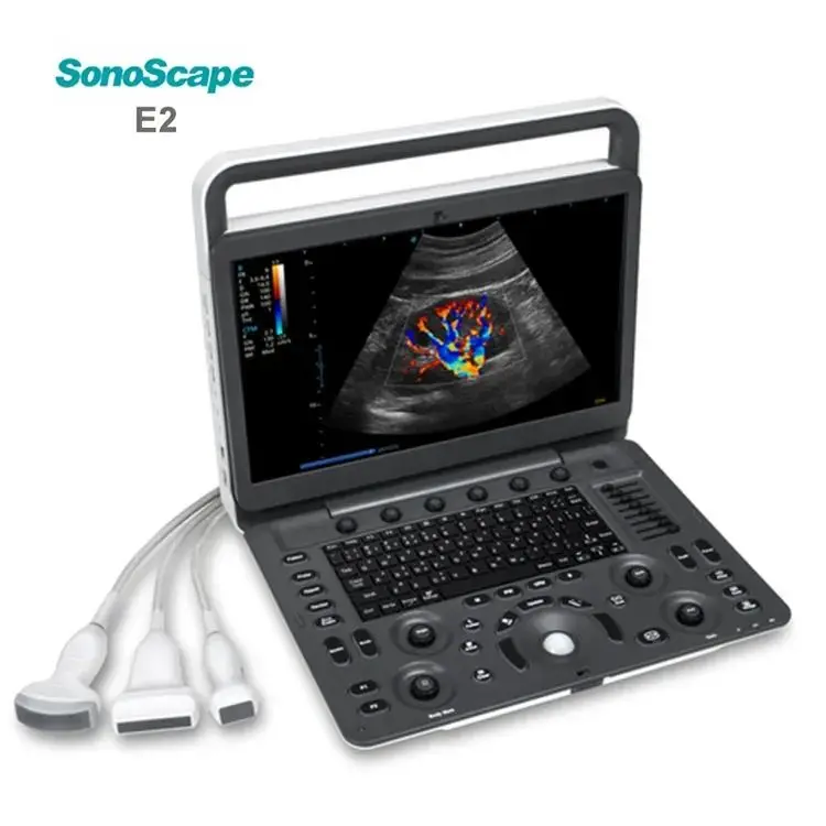 Medical Sonoscape E2 Portable Color Doppler Ultrasound Machine