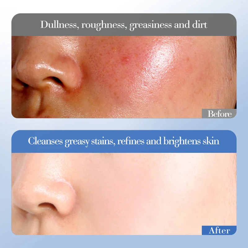 OEM SADOER оптовая продажа белый рисовый никотинамид Осветляющий 6 шт. набор для ухода за кожей Корейская отбеливающая подарочная коробка