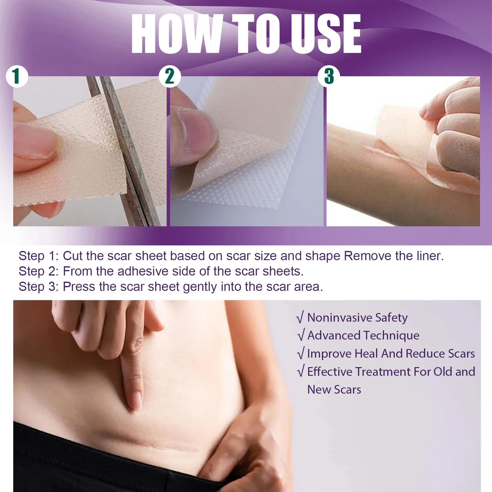 South Moon Silicone Patch Scars Scar Away Gel Sheets Silicone Scar Removal Sheet with size 7.5*4cm