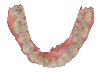 Dental Oral Therapy Equipment Dental Imaging Equipment Dental 3D Intraoral Scanner