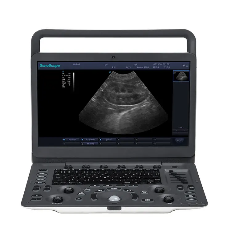 E2V (2).jpg