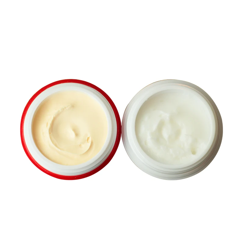 Effect Strong Removal Melasma Whitening Cream Freckle Spe Freckle Enhancing Reduction Sun Removing Cream Fade Dark Spot