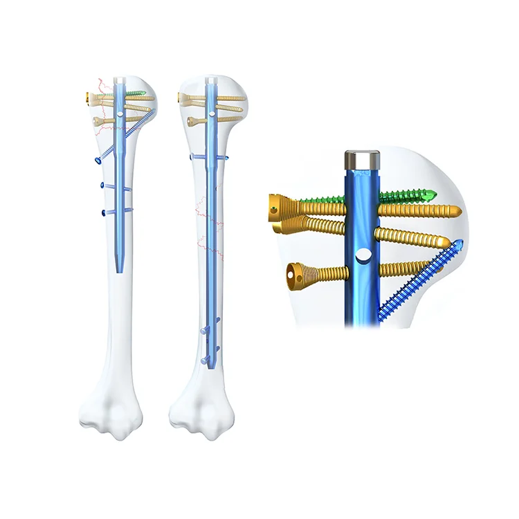 High quality Medical Orthopedic OEM Orthopedic Humeral Nail Instrument Kit