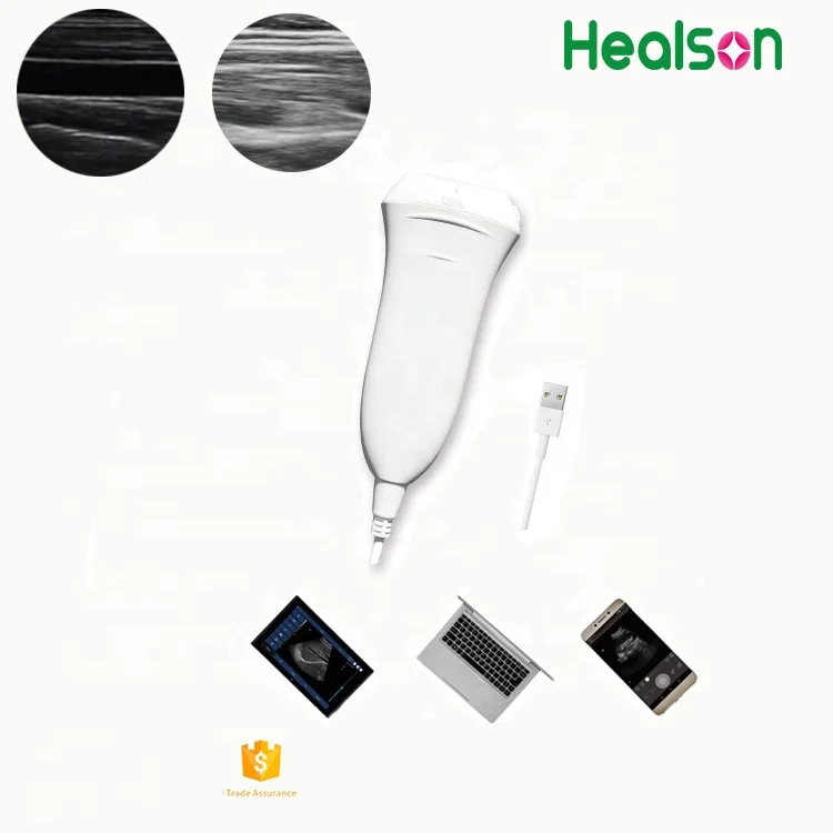 Healson U20L ultrasound lineal probe USB portable /handheld ultrasound machine/system/probe from manufacturer