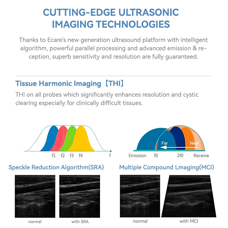 WH-29 Hot Sales color doppler ultrasound machine veterinary ultrasound machine price for laptop computer