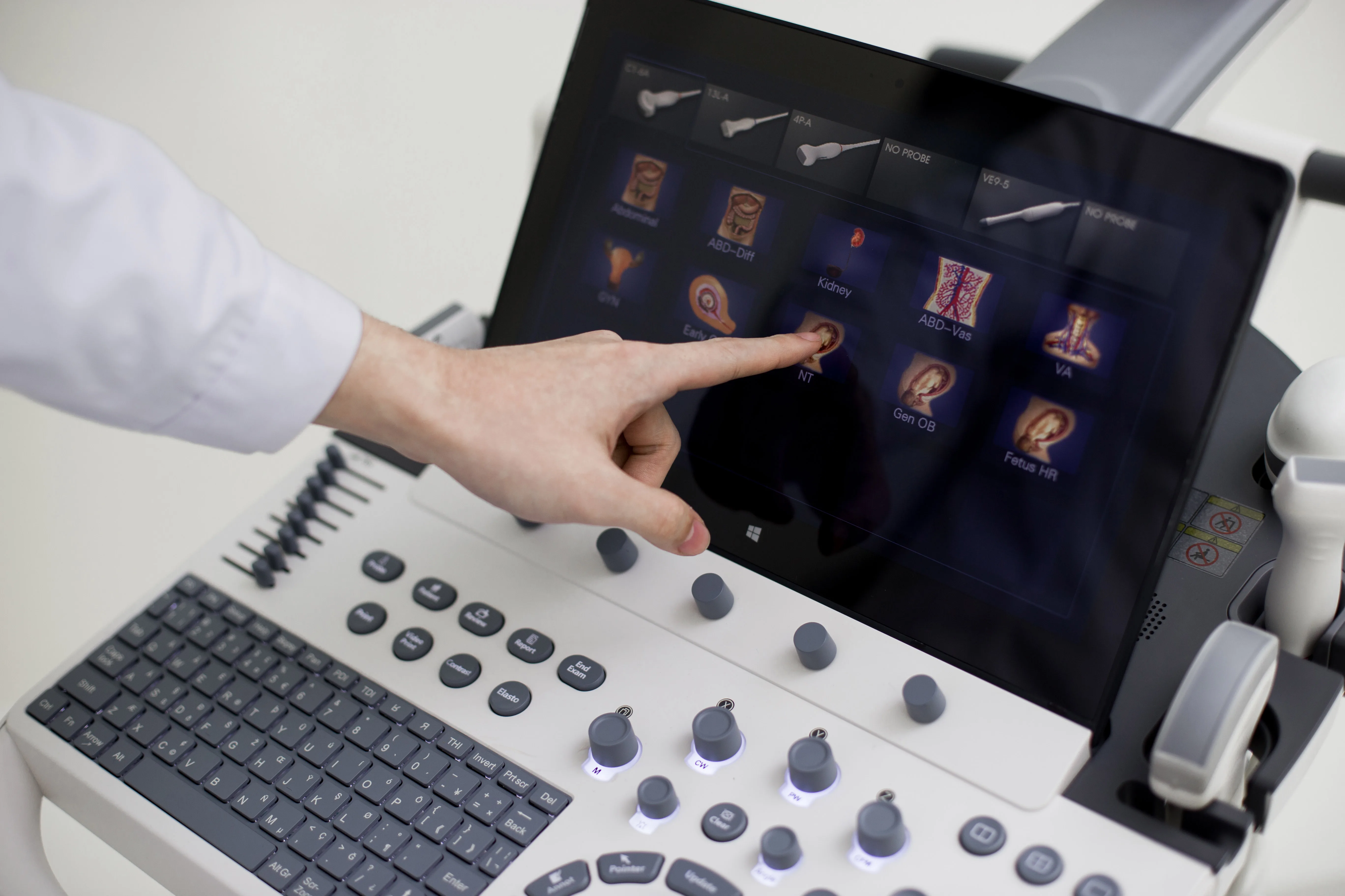 Sonoscape P40 Elite 4D эхографическая машина Ультразвуковая диагностика медицинское оборудование для больниц