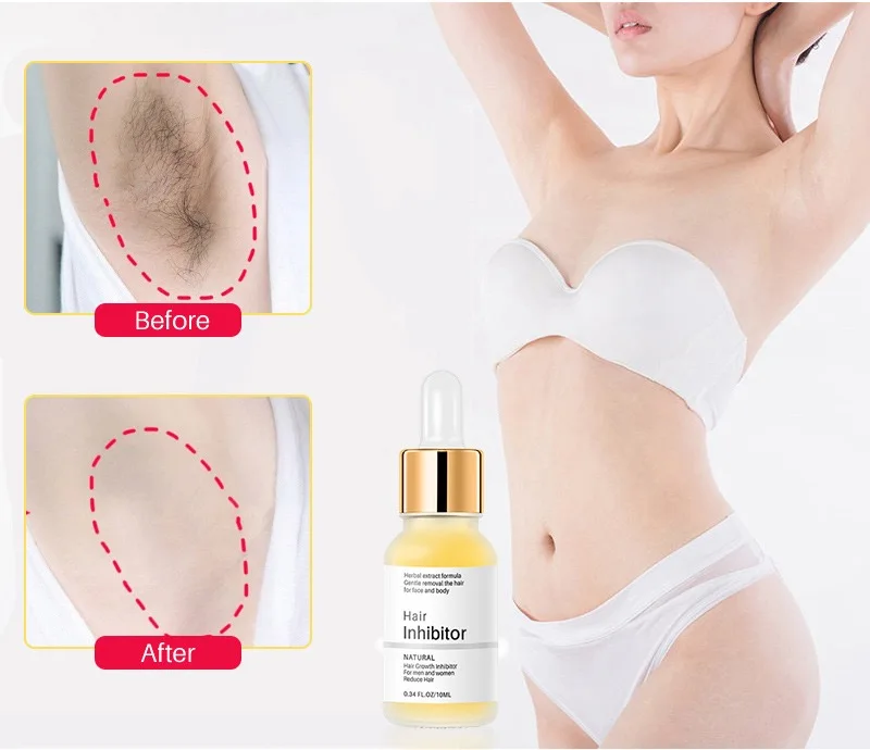 Hair inhibition mild Hair nourishing liquid 10ml dropper bottle