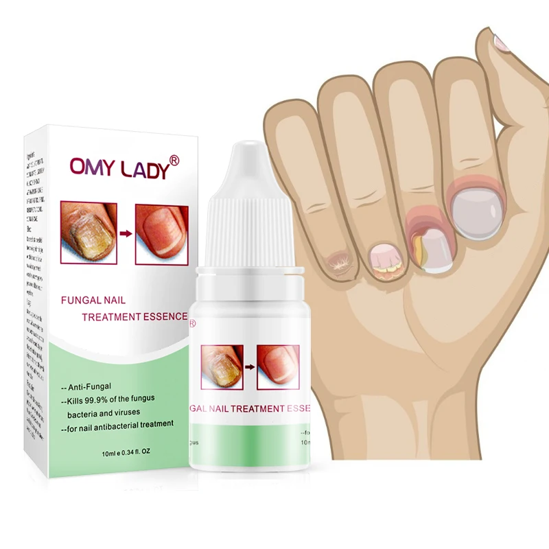 yunnan balala pocket size finger & toe serum vinegar for nail fungus