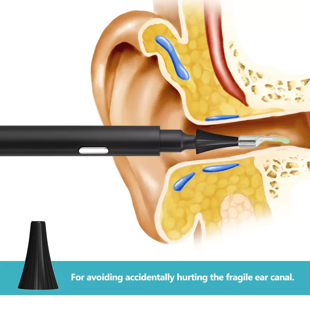 visible ear scoop (5)