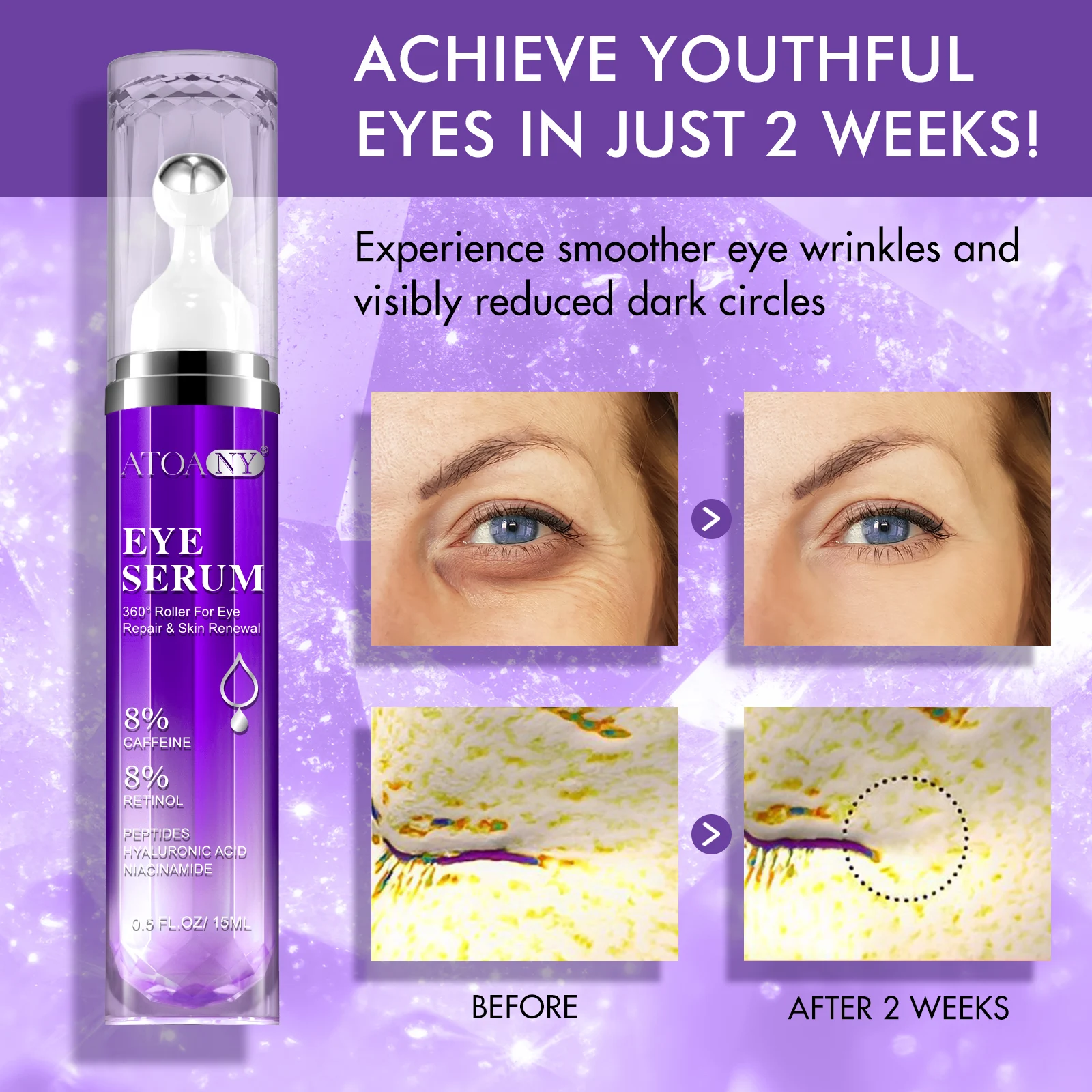 Wholesale Anti Aging Caffeine Eye Serum Eye Bags Removal Retinol Hyaluronic Acid Collagen Eye Serum Roller For Dark Circles