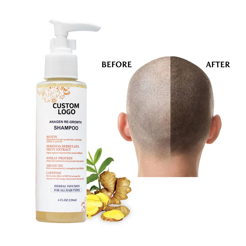 Whole sale high quality china purifying cleaning male hair shampoo anti-dandruff mini hotel mens shampoo products for men