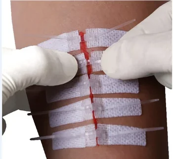 Waterproof local skin wound closure suture sterile strips for hospital use repair wound care skin closure sterile strip