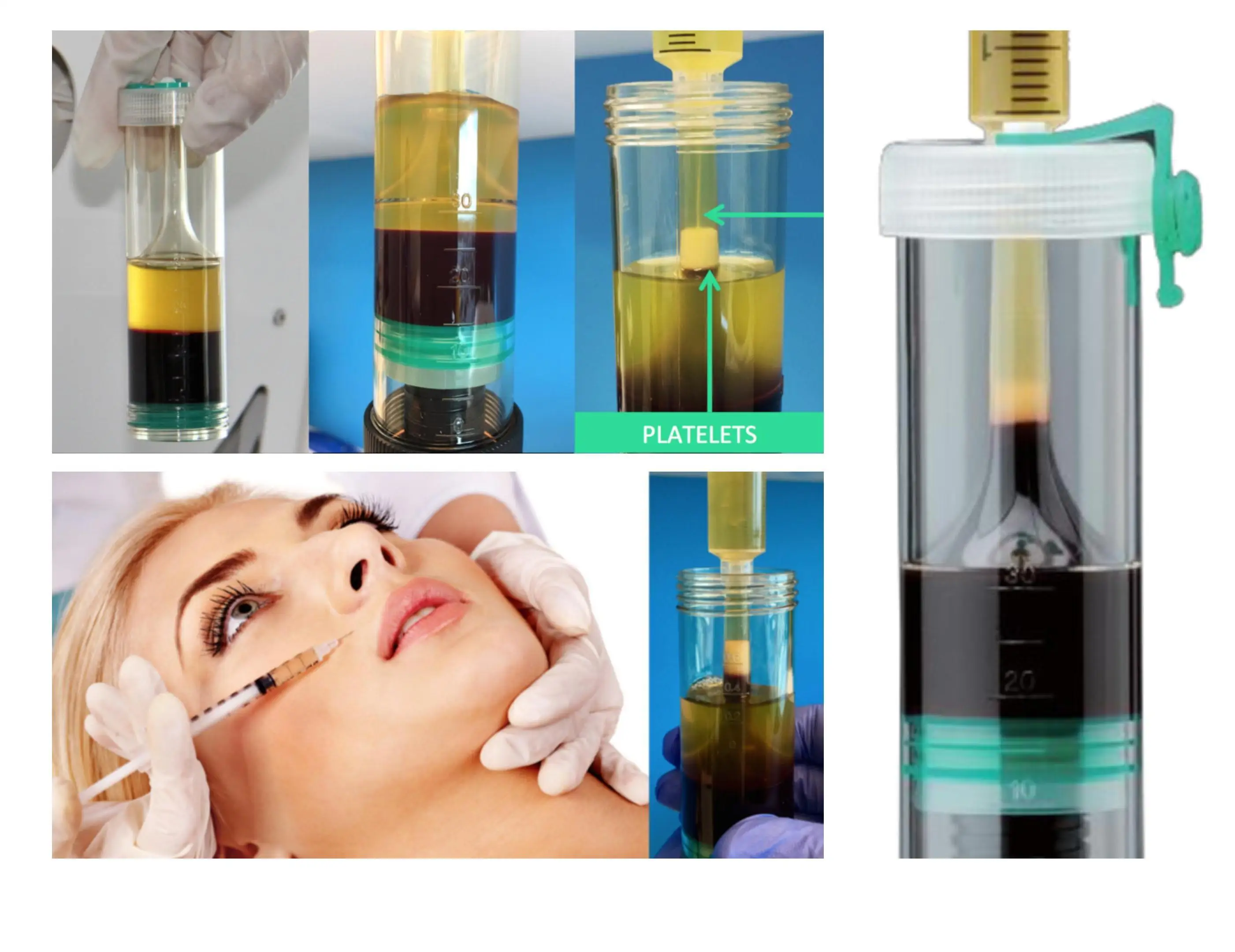Biojoint High efficiency PRO Negensis Pure 10ml 20ml 30ml 50ml 60ml PRP platlet Rich Plasma kits centrifuge