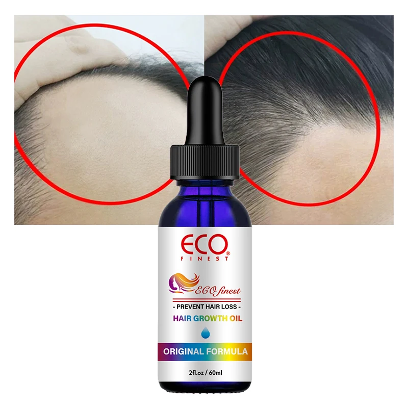 OEM/ODM 100% Pure Essential Oils Burn Fat To Lose Weight Skin Firm Anti Cellulite Slimming Body Massage Essential Oil