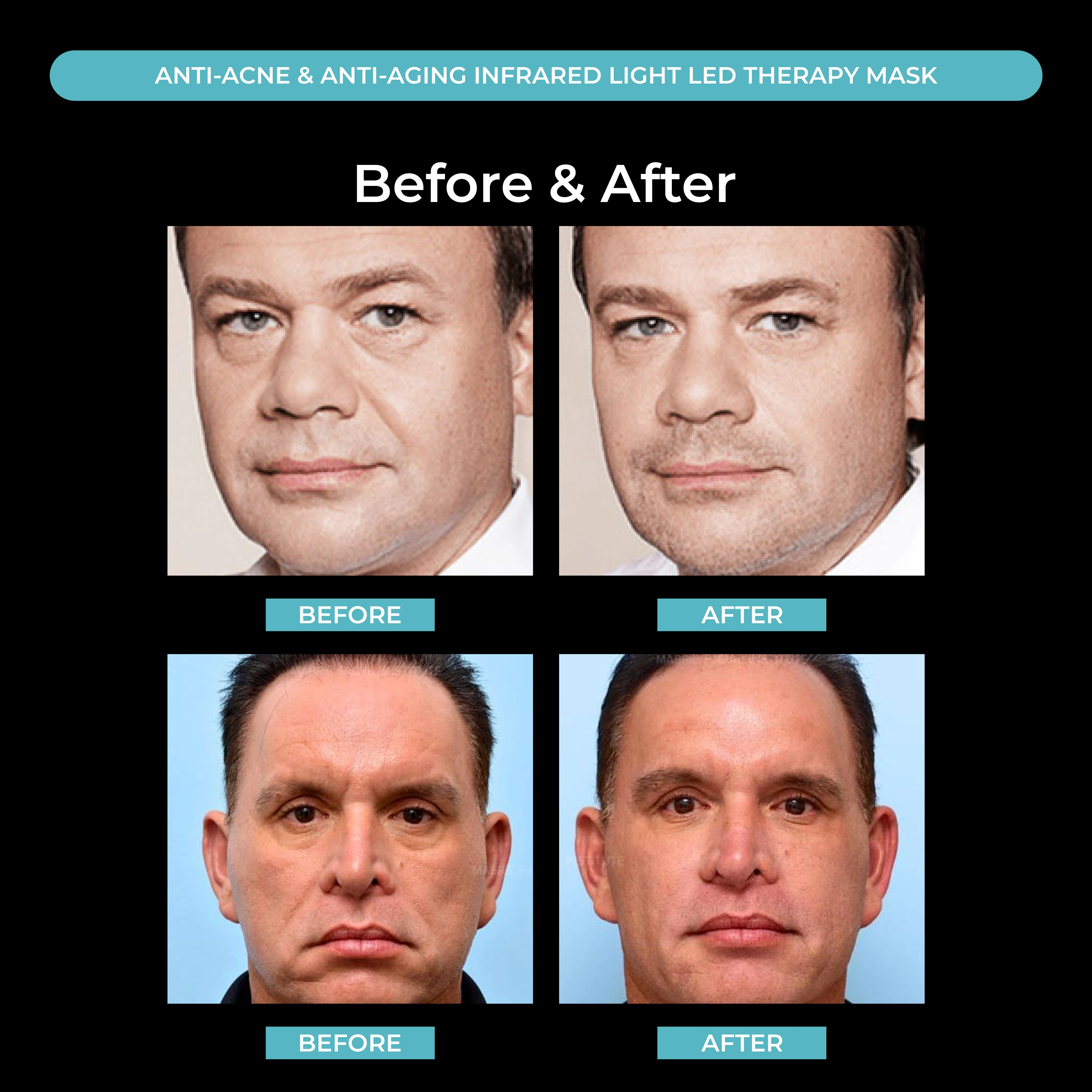 Before And After 660nm Led Mask Face Near Infrared Led Light Therapy Masks Face Facial Light Therapy For Face & Neck Skincare