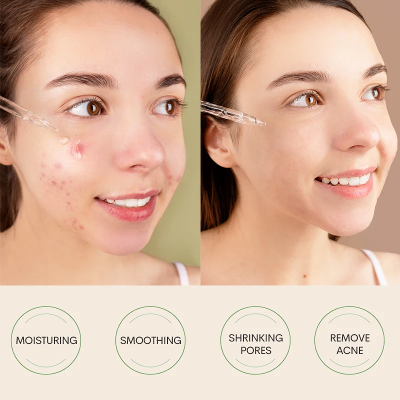 Private Label Anti-Wrinkle Retino Dark Spot Rapid Tone Repair Retinol + Vitamin C Dark Spot Face Serum