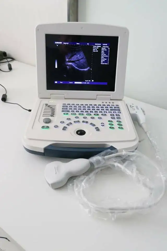 DW-580 price laptop ultrasound, cheap ultrasound equipment