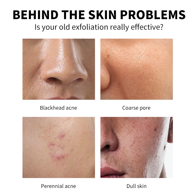 Wholesale Custom Organic Bamboo Charcoal Deep Cleansing Whitening Face Facial Scrub for Mens Wash