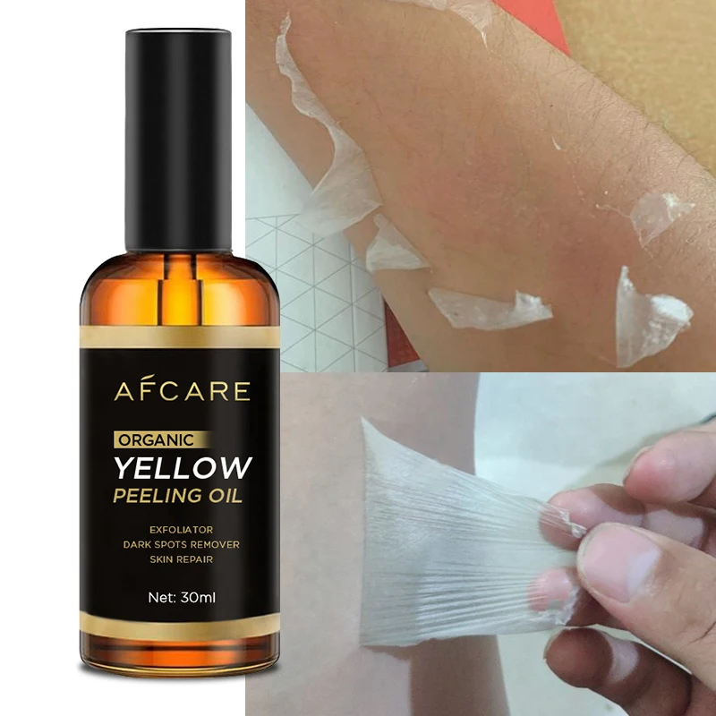 Private Label Yellow Peeling oil Skin Care Strong Paraben-free Smoothing and Shea Butter & Mineral Lightening Peeling oil