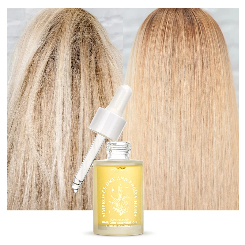 MELAO Private Label Wholesale 100% Natural Formula Nourishing Scalp Elixirs Hair Care Loss Treatment Hair Growth Oil Serum