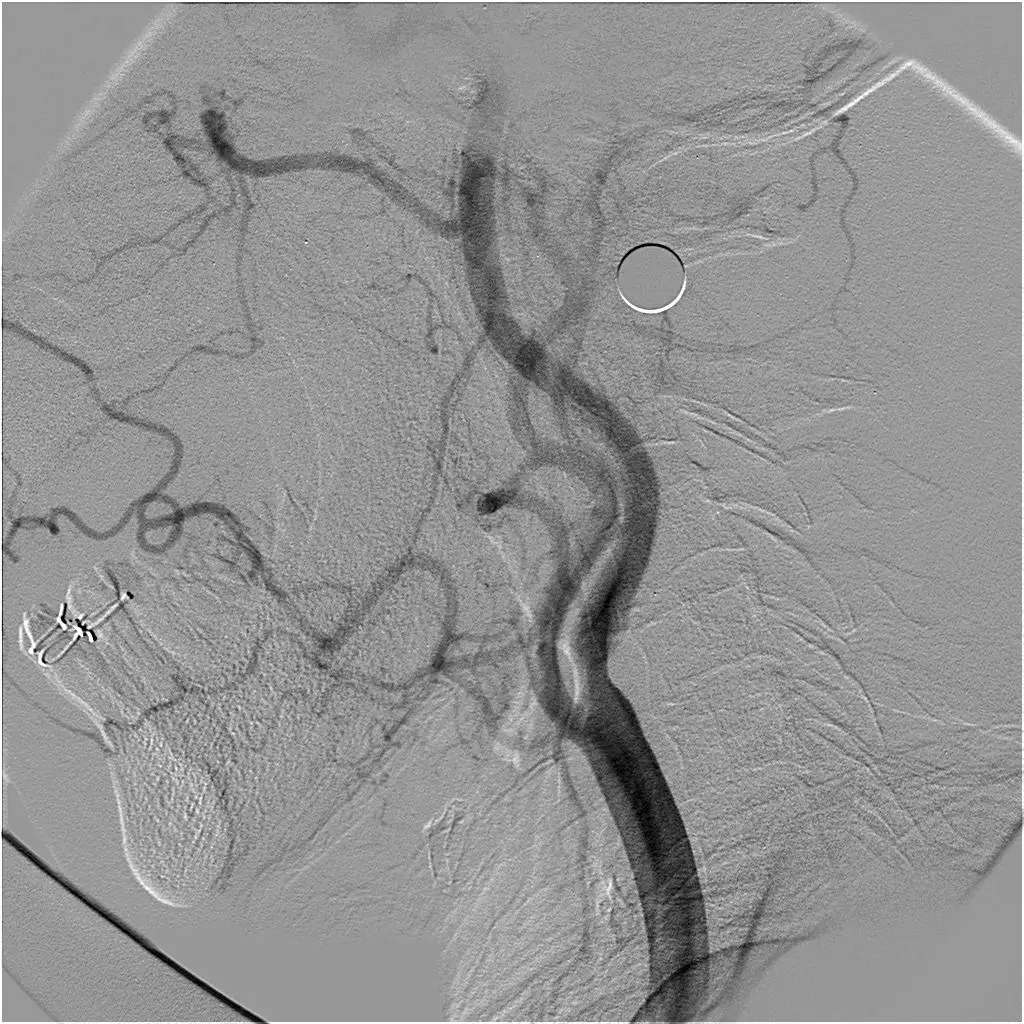 ORICH MEDICAL With Wholesale OX-C500 Surgical C-arm with High Power Generator Manufacturer