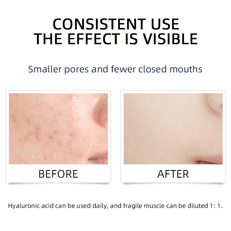 
Ready to ship 200ml Moisturizing Rose Water Hydrosol Shrink pores Organic Rose Floral Water Rose Hydrosol 