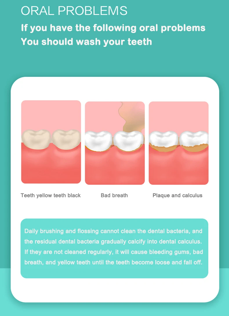 2022 Hot Selling 3 Gear Dental Portable Electronic Ultrasonic Sonic Visual Teeth Whitening For Tartar Remover.jpg