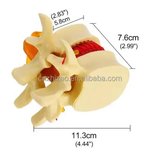 Human Intervertebral Disc Disease Plastic Lumbar Spine Anatomical Model anatomical lumbar spine model