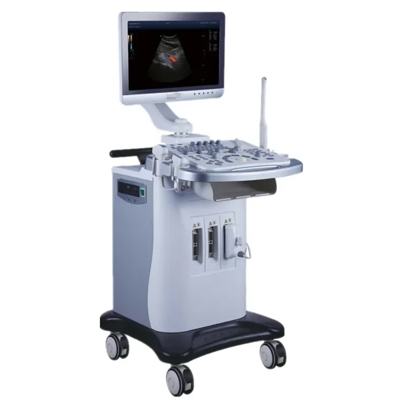 Hospital medical trolley color doppler ultrasound diagnostic instrument advanced device all digital diagnostic ultrasound system