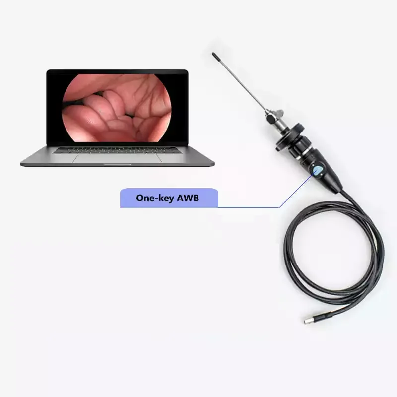 TUYOU Best Portable Medical Endoscope Full HD USB Endoscopic Camera for ENT Surgery