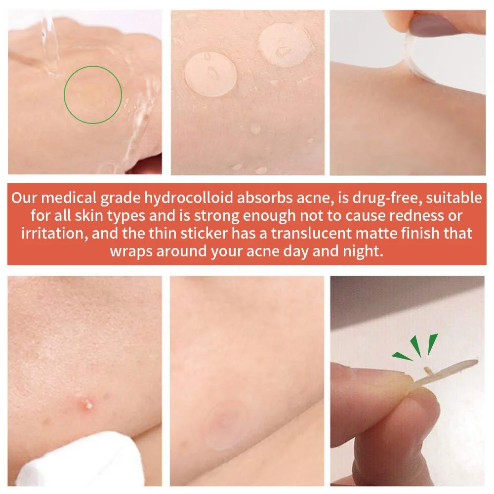 OEM Hydrocolloid Acne Pimple Patches Customized Bule Box Logo 39 Dots Invisible Blemishes Organic Healing Pimple Patch
