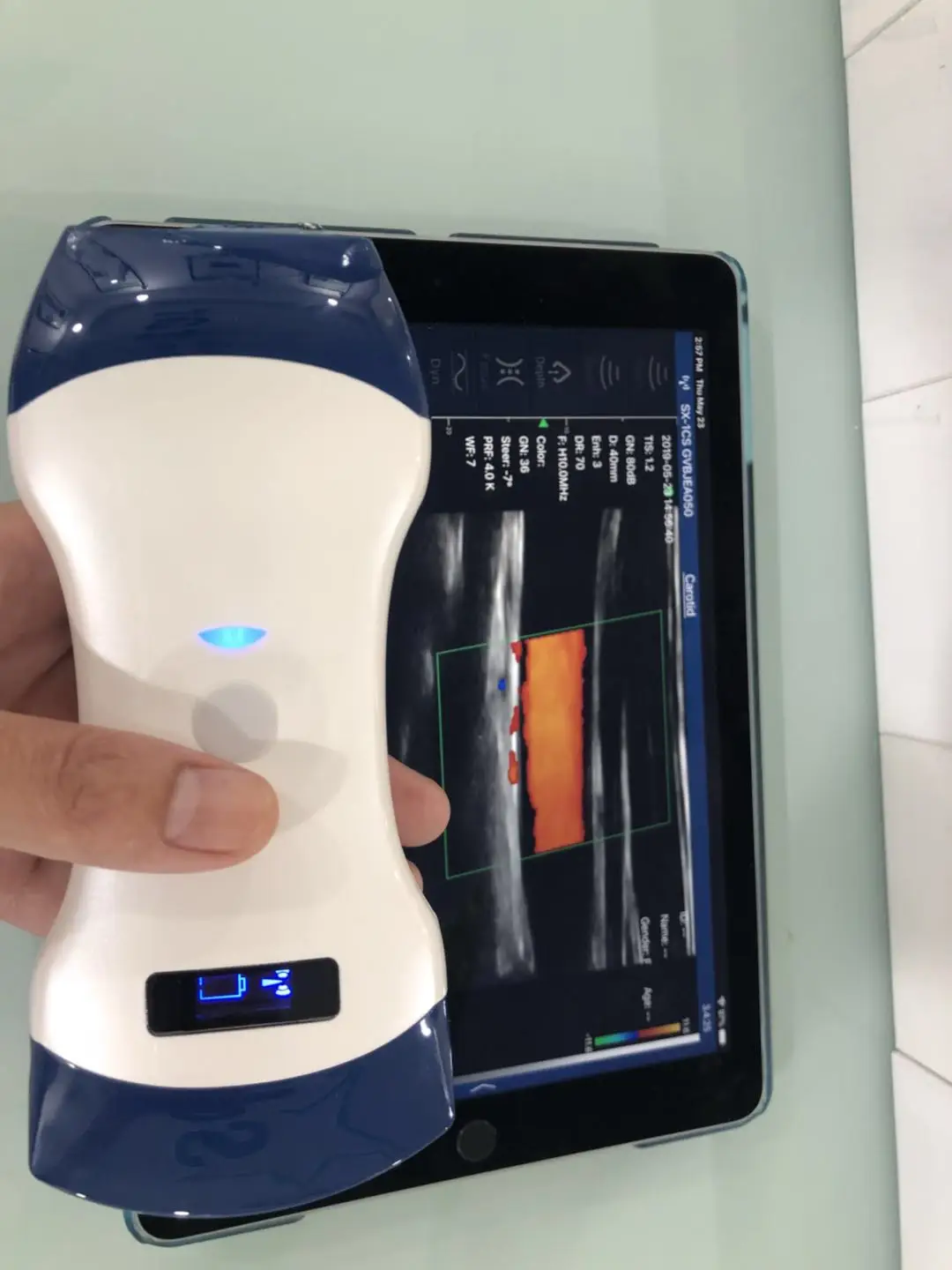 Цветной Допплер Беспроводной ультразвуковой сканер электрические пластиковые Ce HF он-лайн служба технической поддержки 2 лет 128 элементов 3,5/5 МГц Класс II