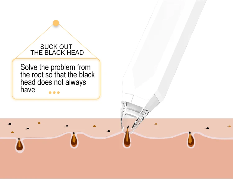 Send Inquiry to Get Free Samples pore vacuum blackhead remover Usb Rechargeable Acne Comedone Extractor Tool Machine
