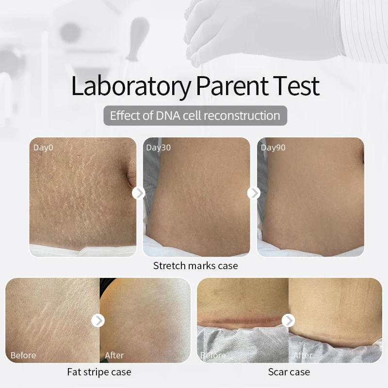 DNA Care Gel Essence Firms, Moisturizes, and Reduces Wrinkles All Over the Body