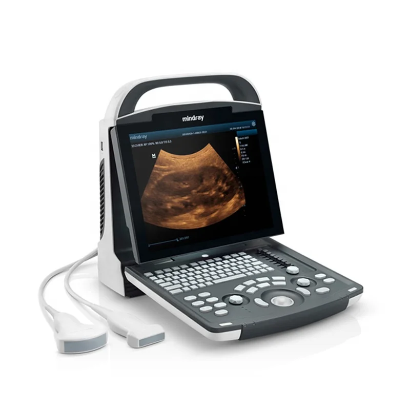 Hot sale ultrasound scanner price ultrasound scanner white black dp 10 mindray ultrasound machine china