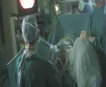 urology diode laser system 120W 1470nm laser