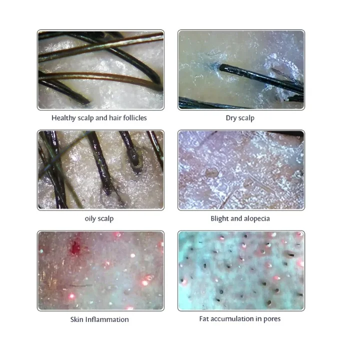 15 inch Skin Analyzer Hair Scalp Testing Scanner Hair Follicle Detector Skin Detector Moisture Tester for Beauty Salon 50X 200X