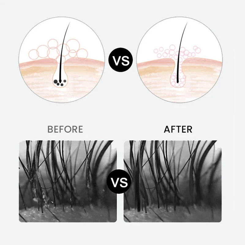 Joinshine Mild Foam Lash Cleanser Vegan Whipped Foam Eyelash Shampoo Custom Personalised Lash Shampoo Concentrate