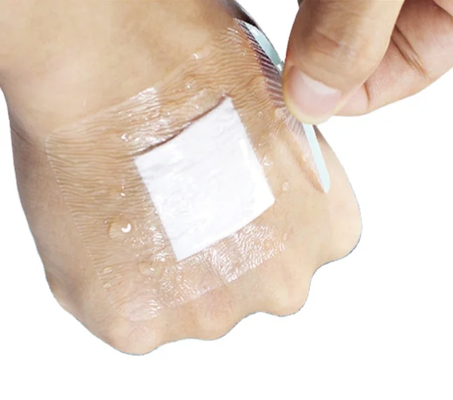 Transparent Film Dressing Iv Cannula Dressing  Adhesive Film wound care dressing navel sticker for baby medical consumables