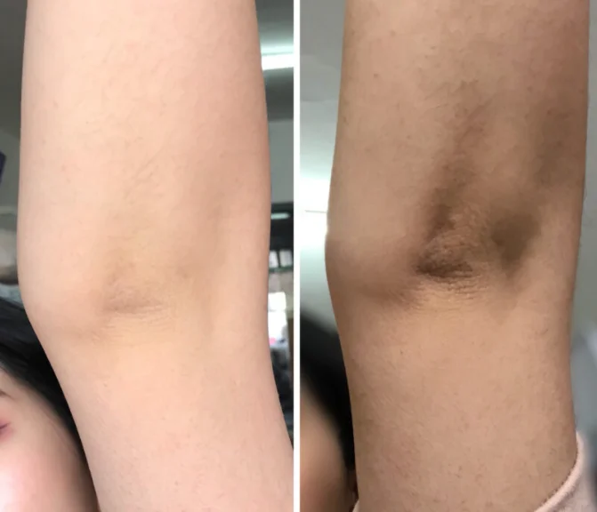 Peeling Oil Skin Whitening Cream And Lotion Carrot Body Whitening Oil