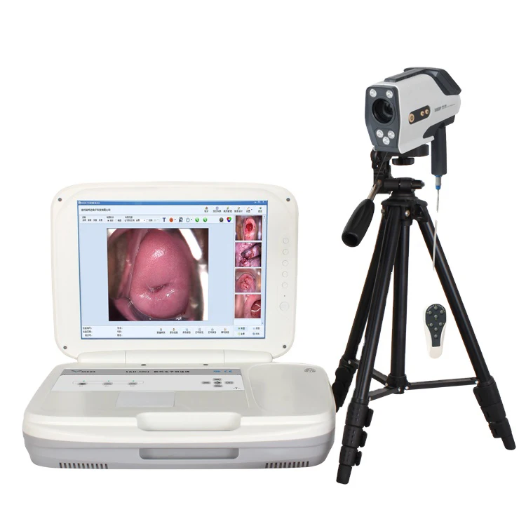 HD Full Digital Electronic Video Colposcope for Gynecology