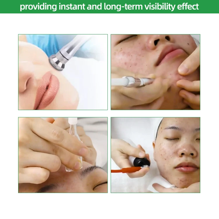 Diamond Dermabrasion Microdermabrasion Facial Care Hydra Machine