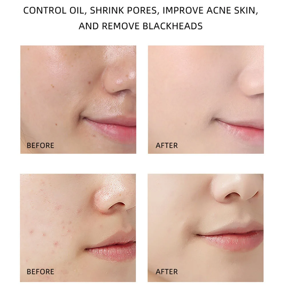 Deep Exfoliation Body Face Scrub Brighten Whitening Dead Sea Turmeric Green Tea Rose Mud Face Mask