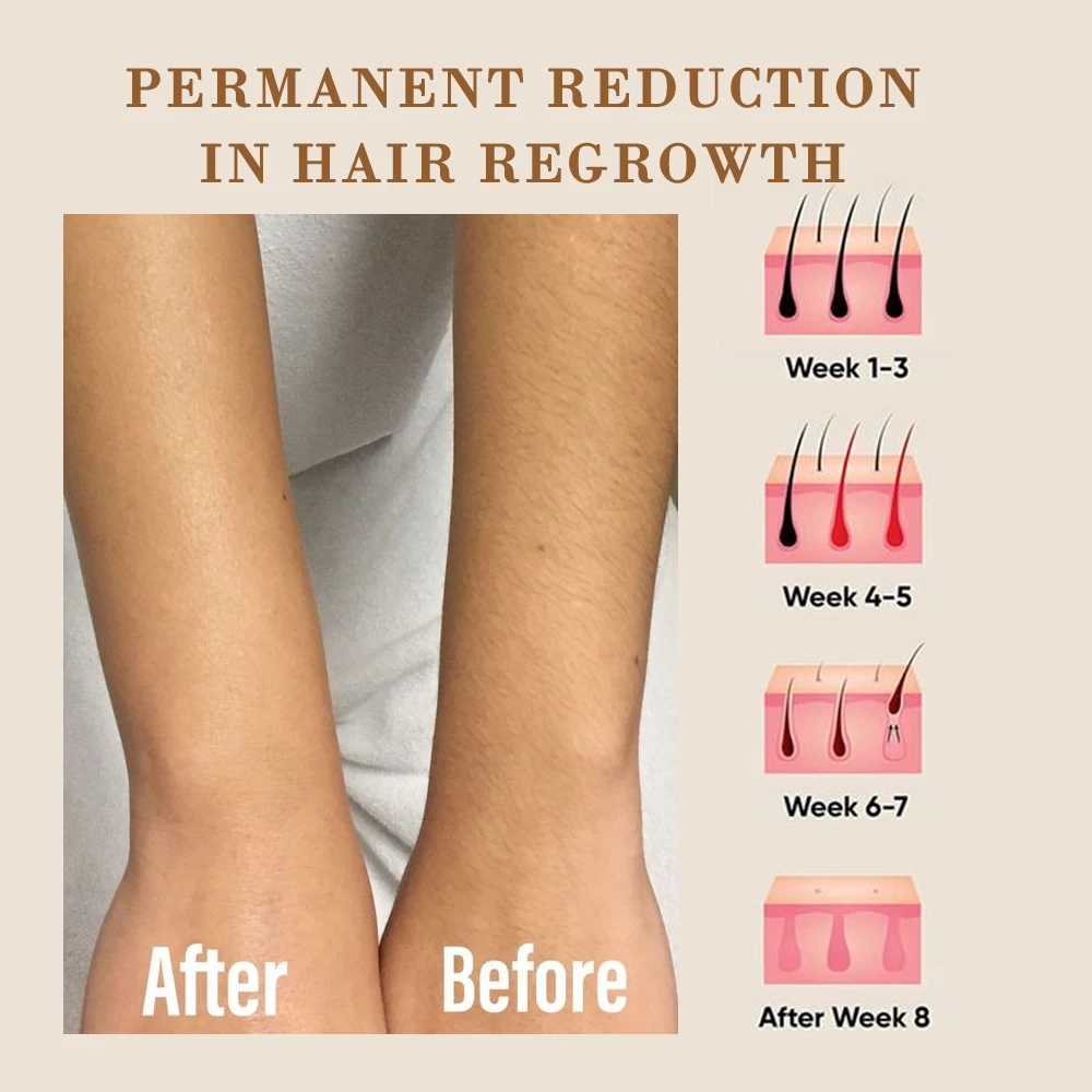 2024 diode laser ice 3 wavelength 755nm laser hair removal 4 wavelength ice painless diode laser with CE ISO TUV