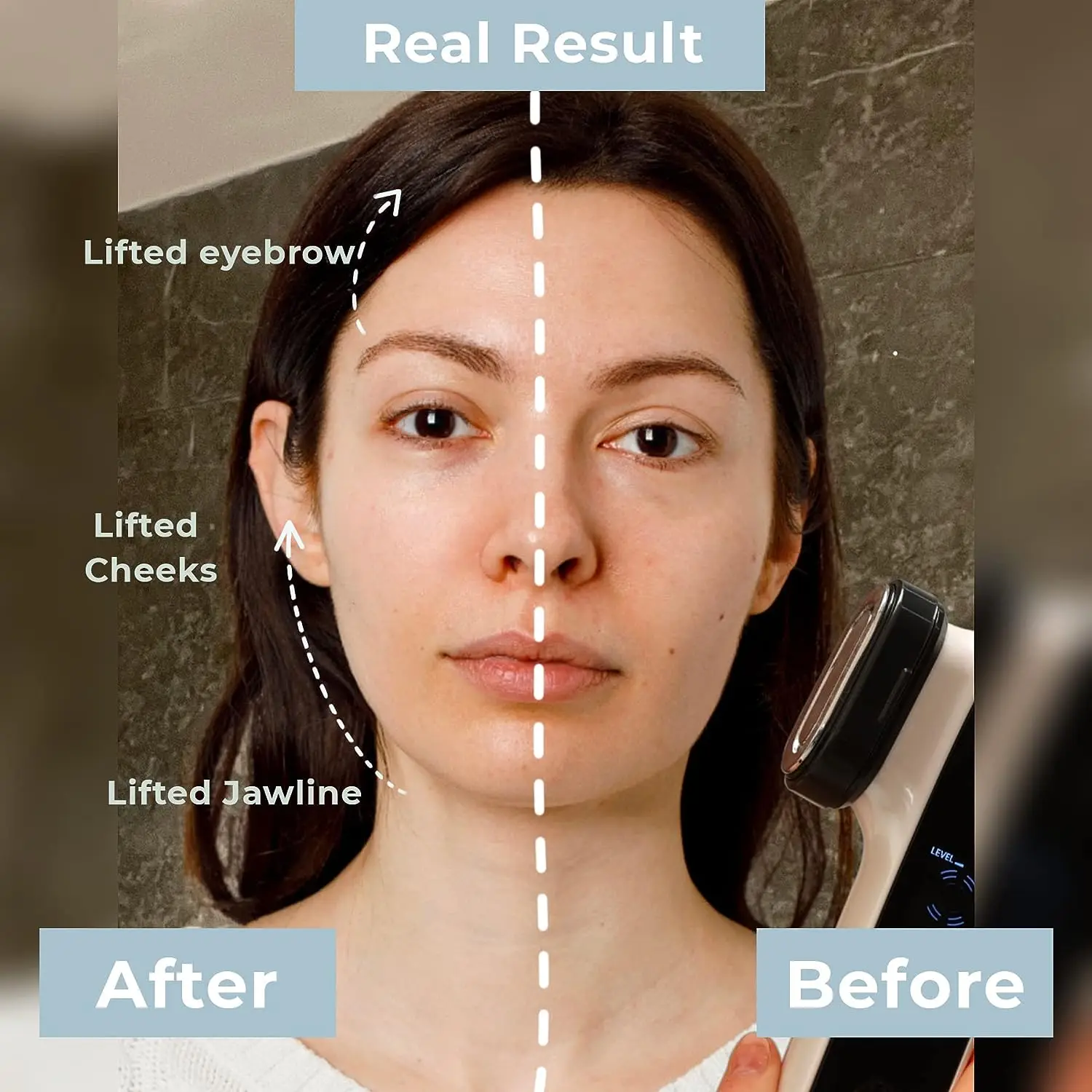 Facial Lift Solution Electrical Muscle Stimulation EMS Facial Massager Multifunctional RF Beauty Device