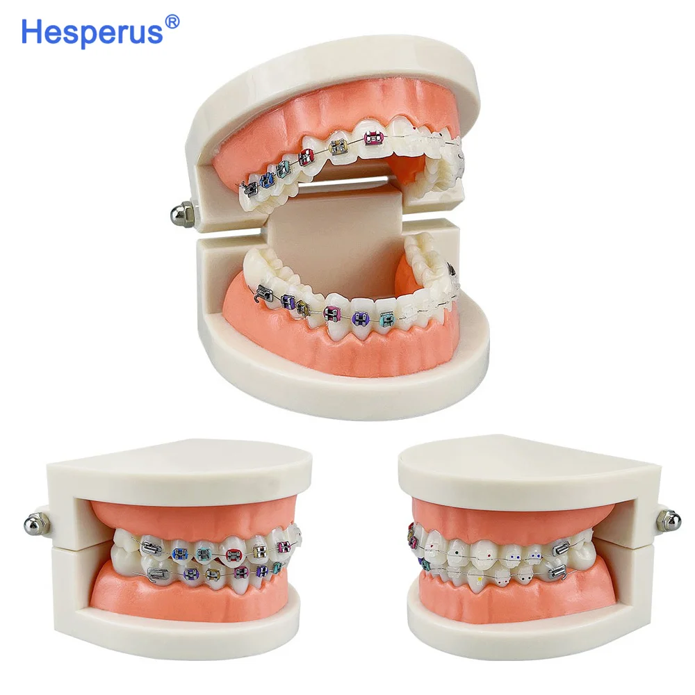 Dental Model Standard Dental Orthodontic Teeth Model With Braces Metal / Ceramic Brackets For Dentistry Education Study HESPERUS