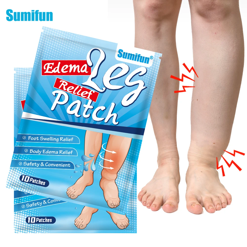 Sumifun Leg Edema Relief Patch Arm Thigh Dropsy Oedema Massage Sticker Shank Swelling Pain Relief Medical Plaster