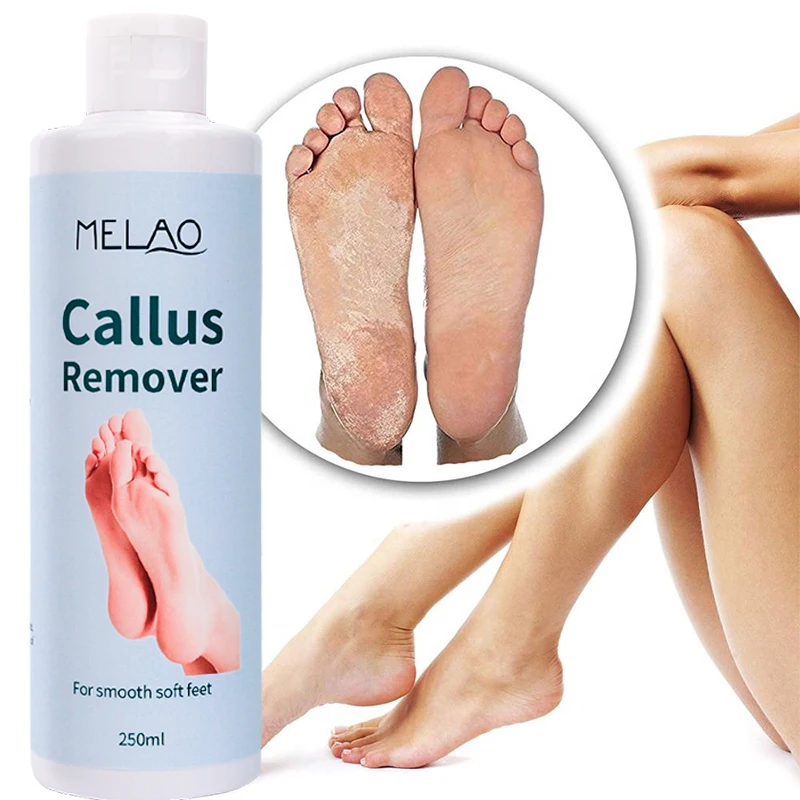 2022 OEM Private label organic 250ml moisturizing anti inflammatory foot callus remover