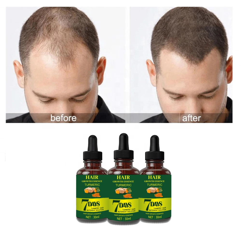 Private label Organic Hair Regrowth Treatment for  Anti-Hair Loss Hair Growth Serum