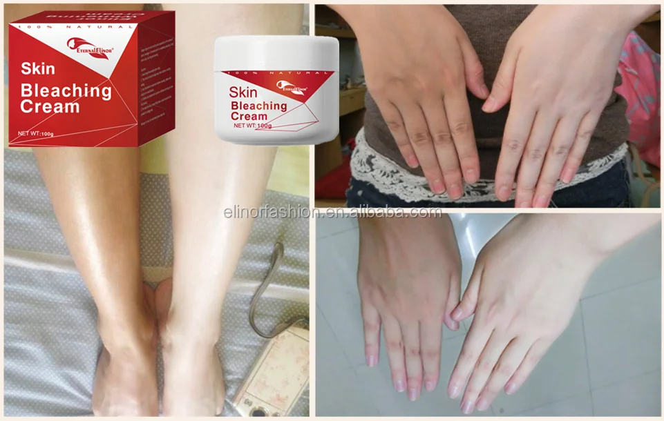 Eternal Elinor Best Skin Bleaching 7 days  Whitening fast bleaching fast skin whitening  Beauty Face Cream